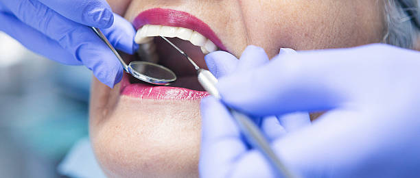 Best Emergency Dental Surgery in St Clair, MO
